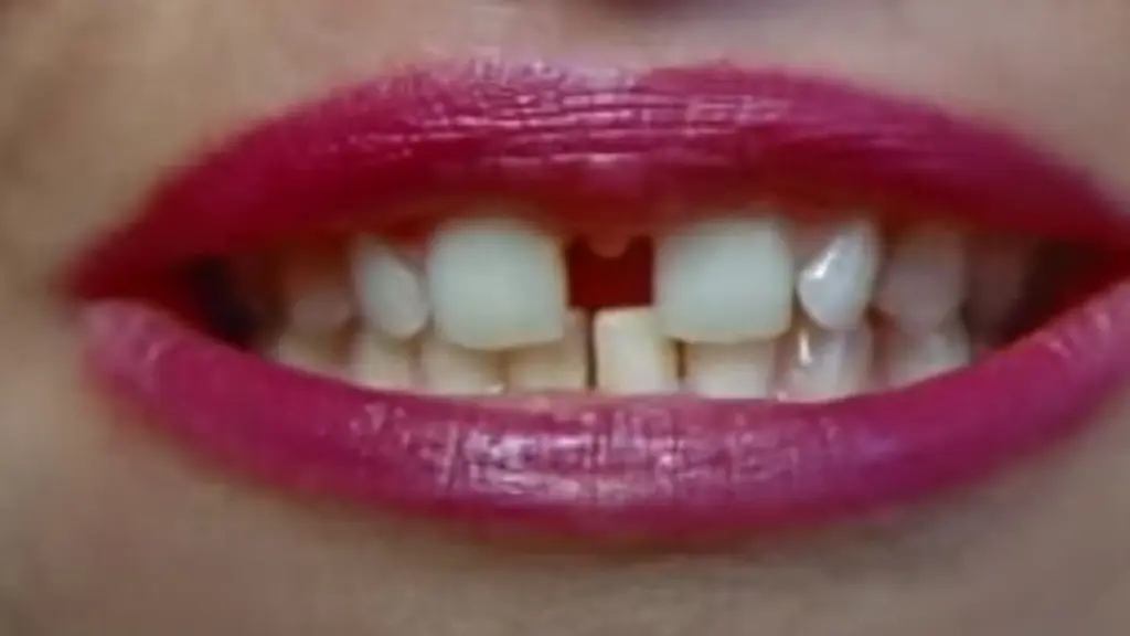 Gap-Toothed Women